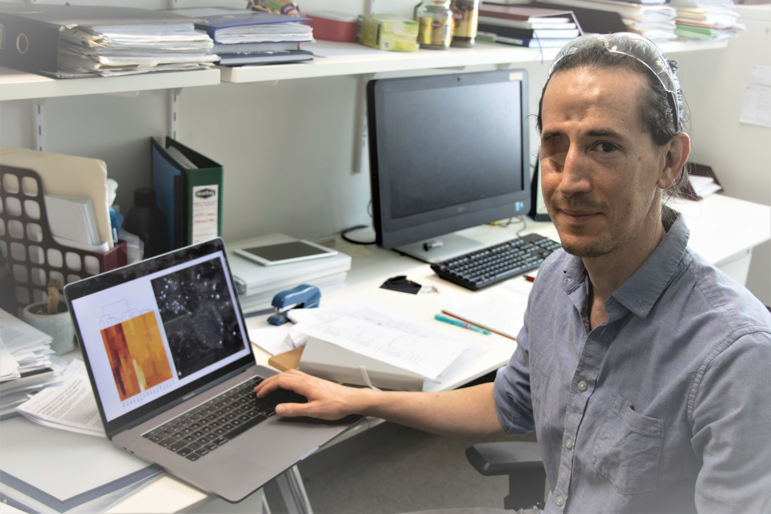 Sam Nayler ataxia telangiectasia 2022